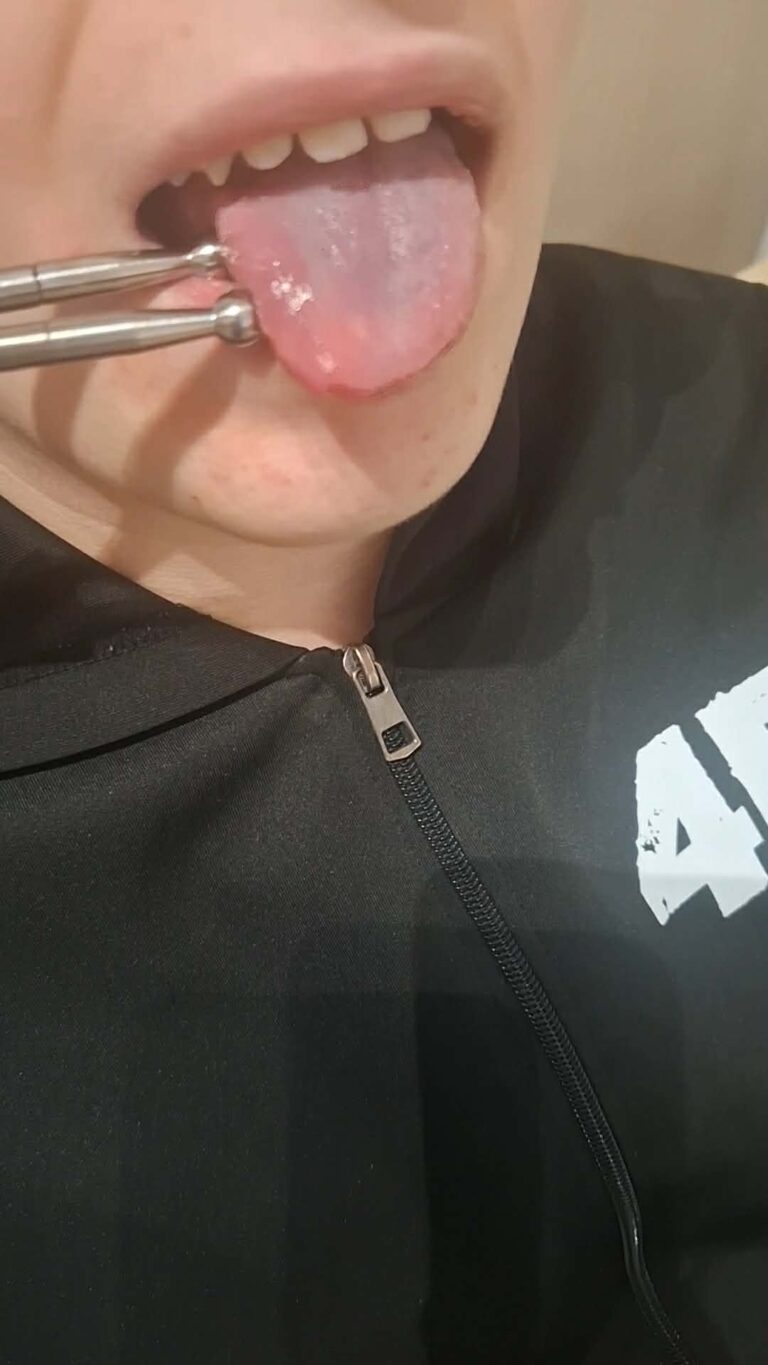 Elektrostymulacja TENS i EMS w LOGO SENSUM Busko-Zdrój, zdjęcie 10